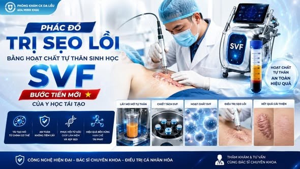 cong-nghe-cay-hoat-chat-tu-than-svf-1-1783079431.jpg