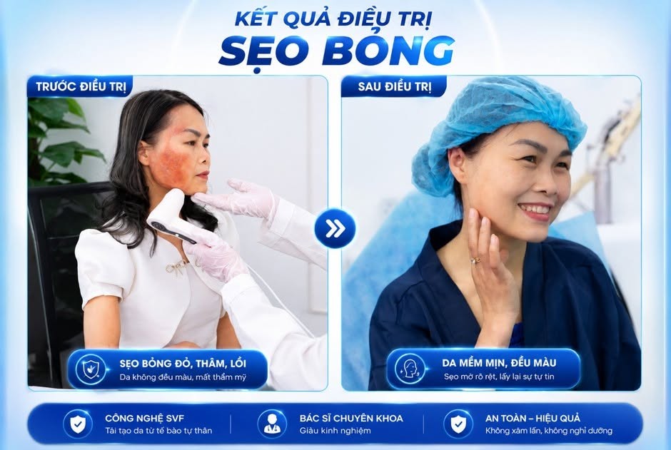 cong-nghe-cay-hoat-chat-tu-than-svf-6-1783079431.jpg