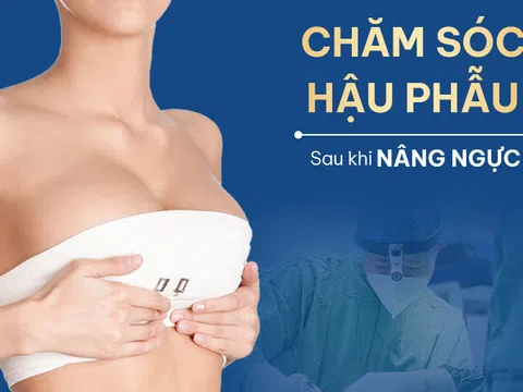 Chăm sóc hậu phẫu sau treo sa trễ – Những lưu ý giúp hồi phục nhanh và duy trì hiệu quả